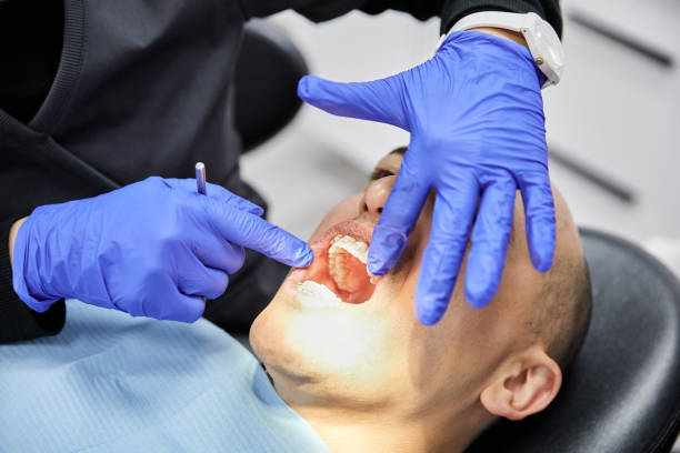 Best Teeth Whitening  in Thunder Mountain, NM